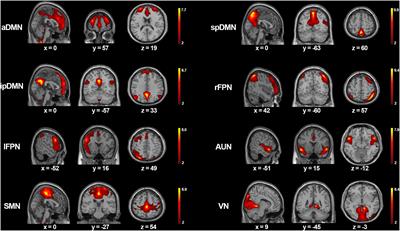 Alterations in intra- and inter-network connectivity associated with cognition impairment in insulinoma patients